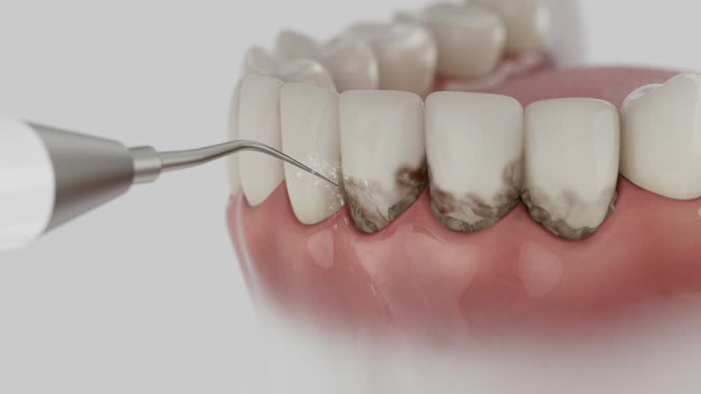 Trusted Teeth Cleaning And Checkup service in Freeport, FL - Dentist Open Now